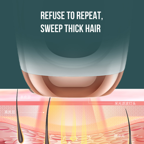 FY-B504 IPL Hair Removal